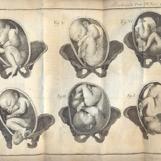 Opere anatomiche e cerustiche, e accresciute di note, e di supplementi dai chirurghi Gio. Antonio Penchienati e Gioanni Brugnone.