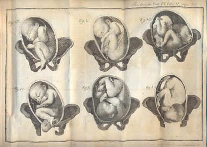 Opere anatomiche e cerustiche, e accresciute di note, e di supplementi dai chirurghi Gio. Antonio Penchienati e Gioanni Brugnone.