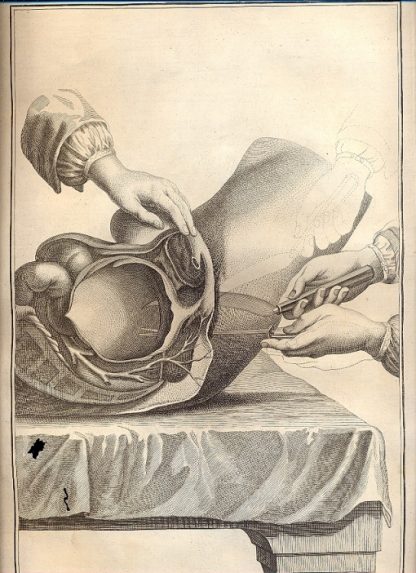 Chirurgie - tavola n. XIV.