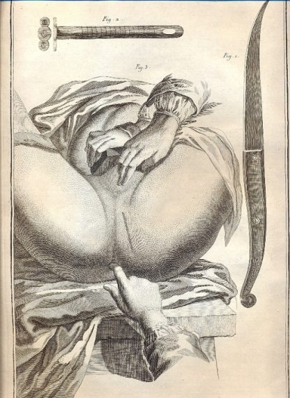 Chirurgie - tavola n. XIII.